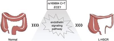 Susceptibility of ECE1 polymorphisms to Hirschsprung's disease in southern Chinese children